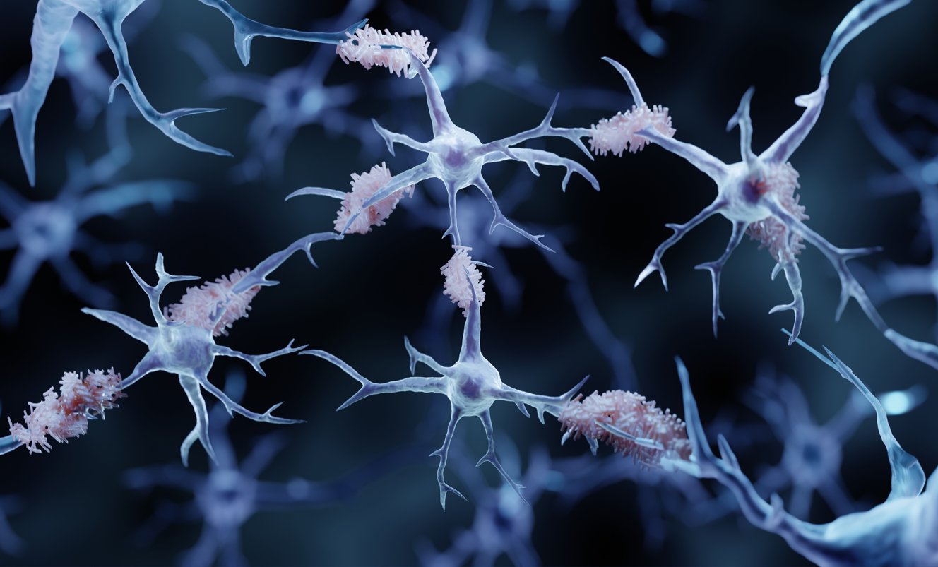 Accelerating Alzheimer’s Research